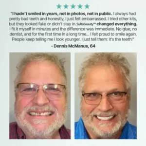 Full Denture - Image 2
