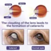 NanoCare Pet Eye Drops