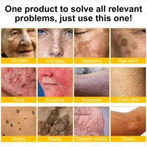 Ultimate All-Body Skin Restoration Cream - Image 3