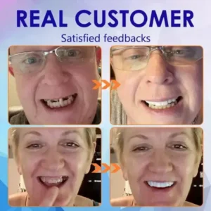 Ease Dentures - Image 3