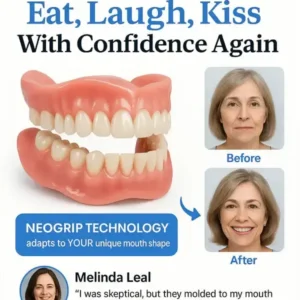 Alternative view of 🦷Advanced Customized Full Denture Set🦷 (🔥10,000+ Sold In Last 30 Day)