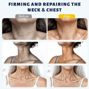 5-Ball Roller Neck Firming Cream with Retinol & Hyaluronic Acid - Image 4