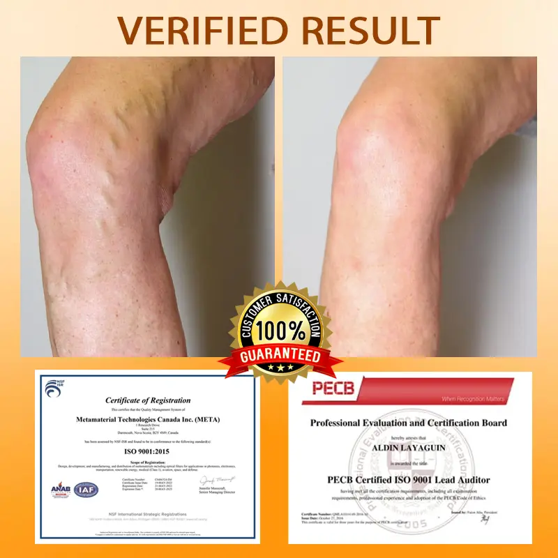 MicroSting Bee Vein Ease Patches - Image 8