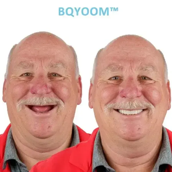 GelFit Dentures - Image 2