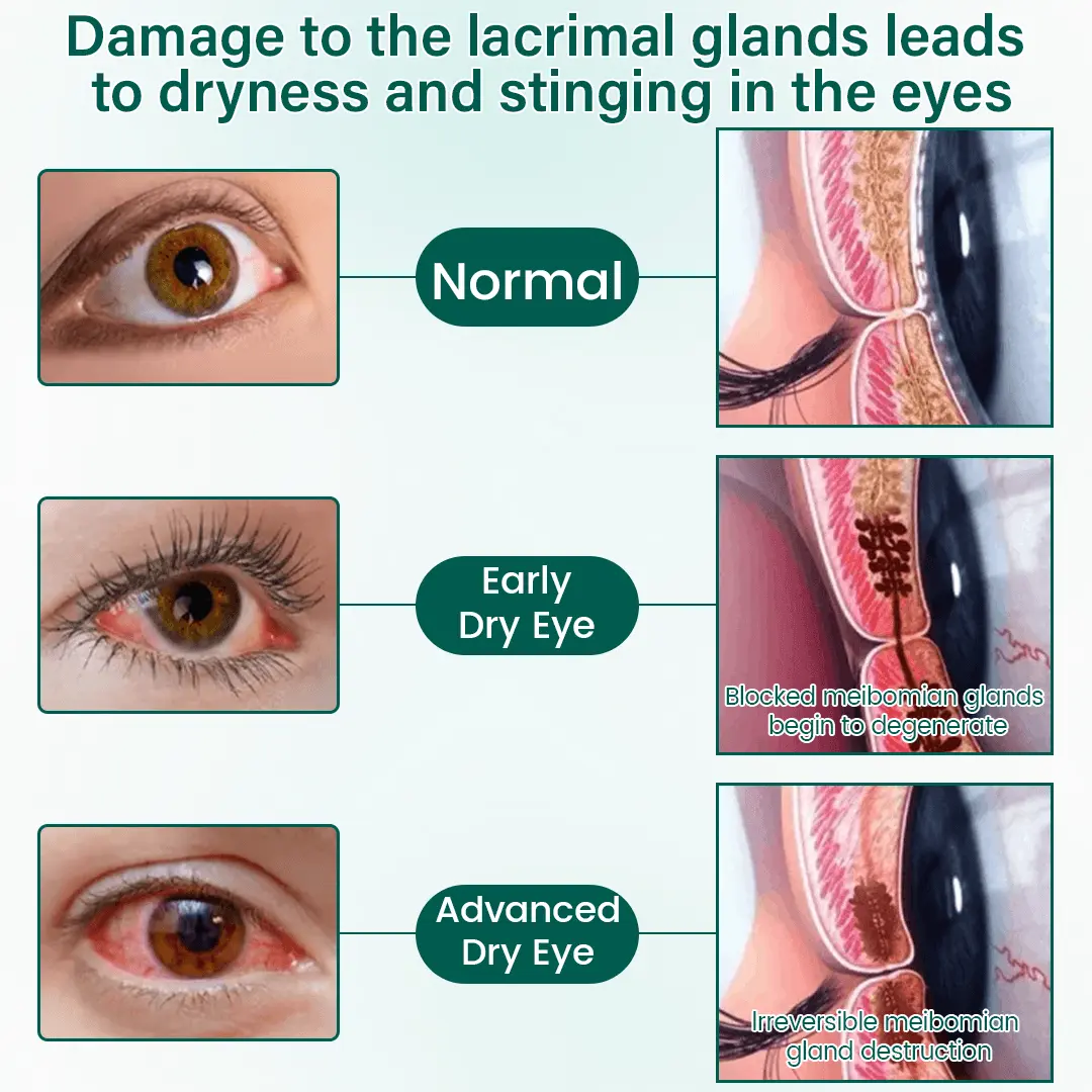 BalanceVie OptiClear Nano Eye Roller Serum - Image 7