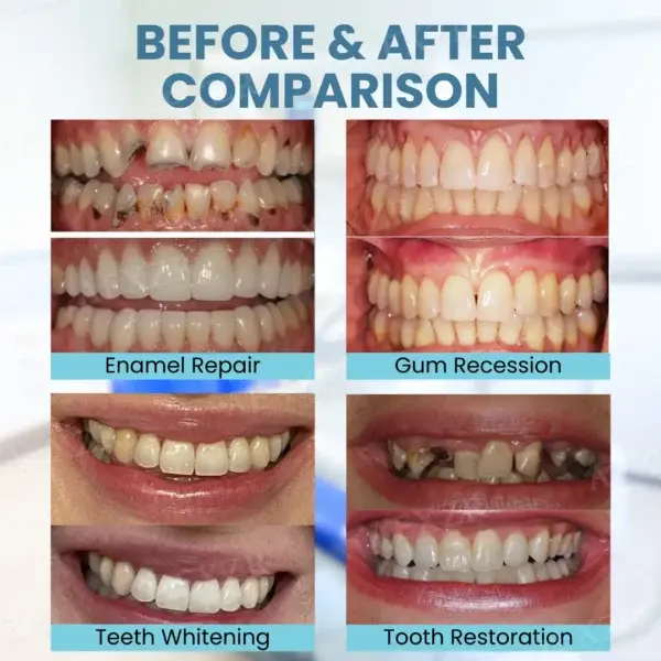 Bee Venom Teeth Restoration Powder - Image 3