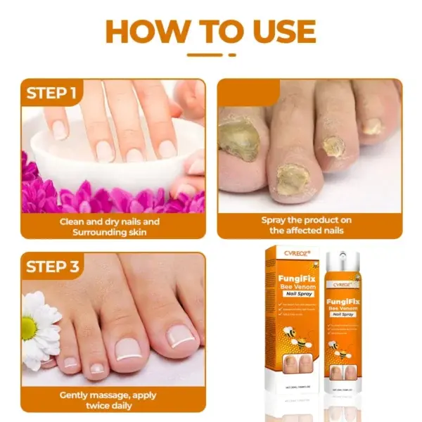 FungiFix Bee Venom Nail Spray - Image 6