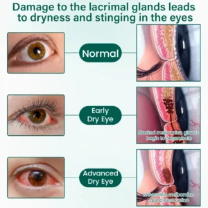 OptiClear Nano Eye Roller Serum - Image 7