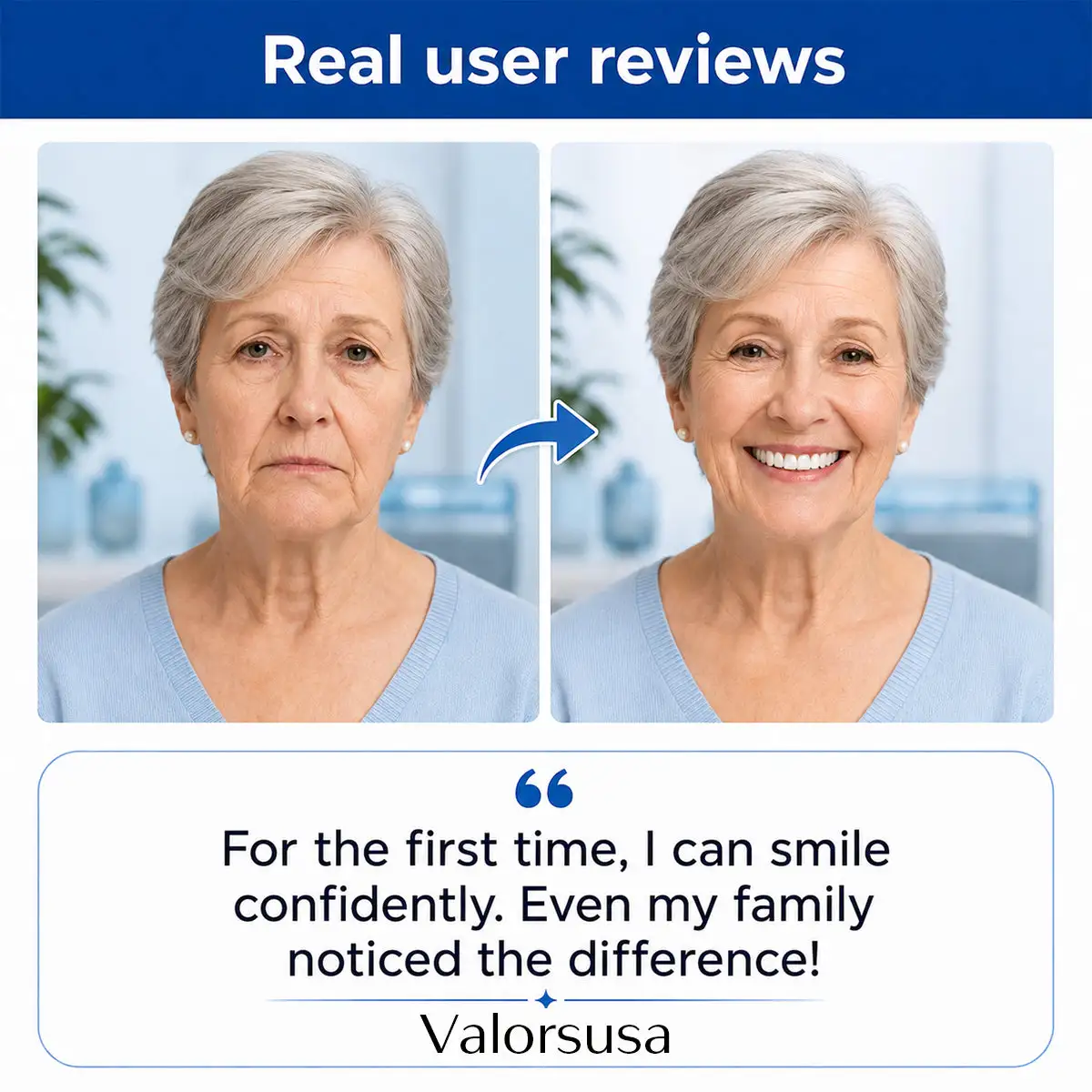 Custom-Fit Dentures for Everyday Comfort - Image 7