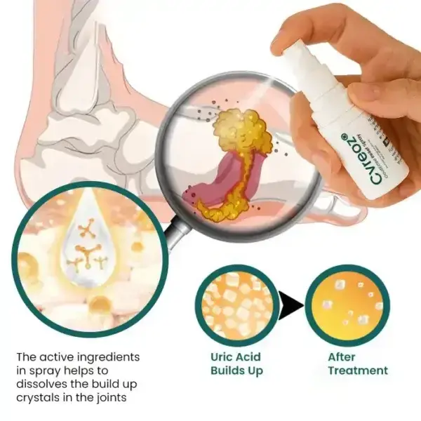 GoutEase Relief Spray - Image 5