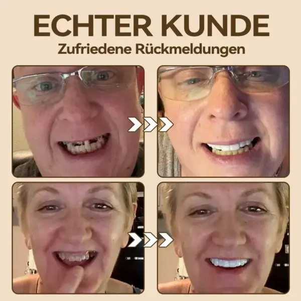 Hidone Premium Gebiss & Zahnprothese aus Silikon kaufen - Image 9