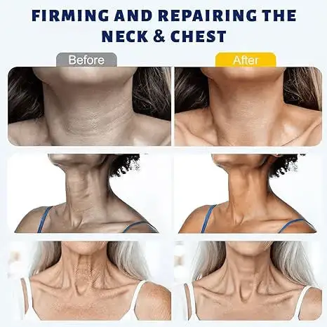 Instant Neck Firming Cream with 5-Ball Roller & Retinol - Image 2