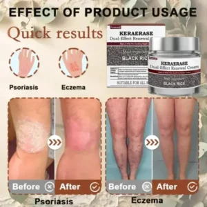 KeraErase Dual-Effect Renewal Cream - Image 12