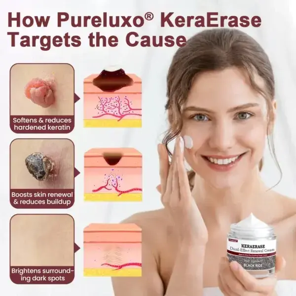 KeraErase Dual-Effect Renewal Cream - Image 6