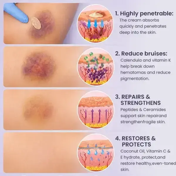 Bruise Repair & SkinStrengthening Cream - Image 12
