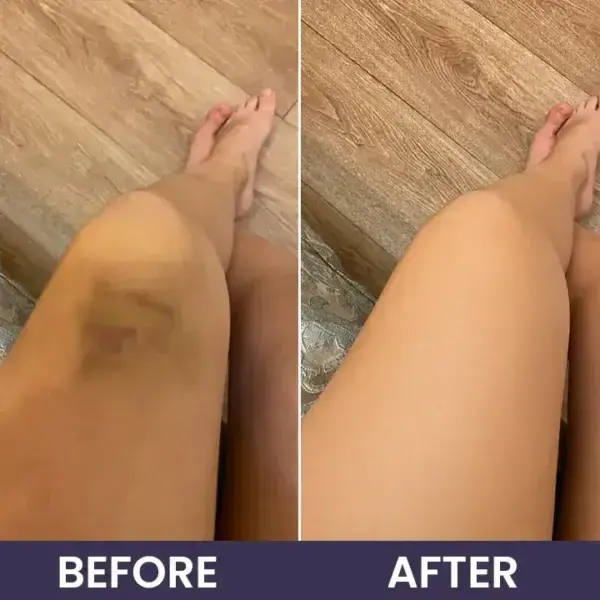 Bruise Repair & SkinStrengthening Cream - Image 14