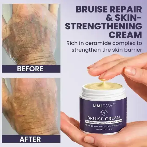 Bruise Repair & SkinStrengthening Cream - Image 4