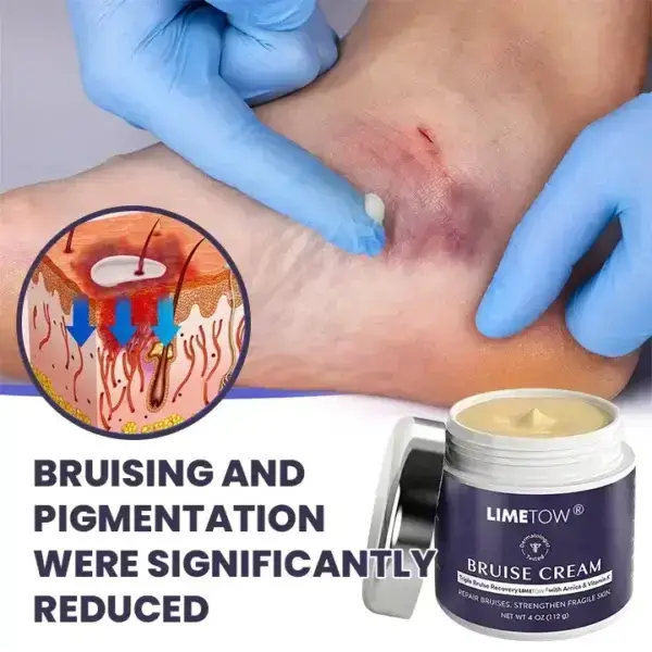 Bruise Repair & Skin-Strengthening Cream - Image 7