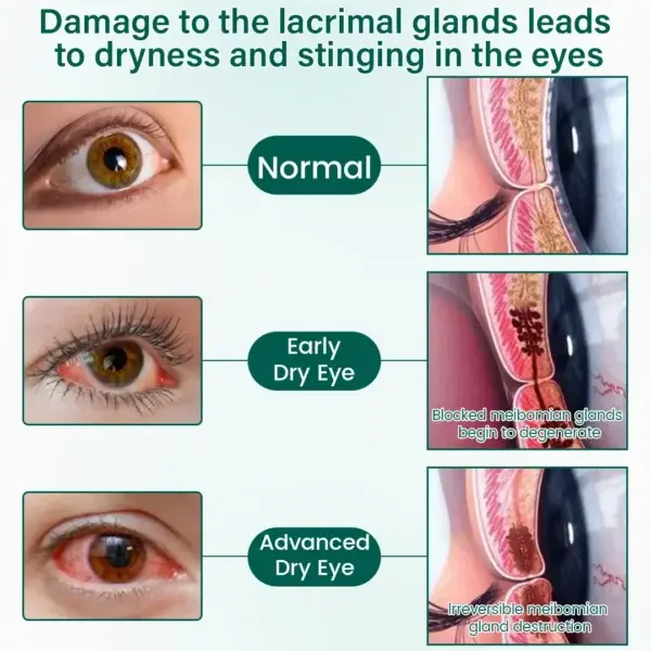 NEYEROS OptiClear Nano Eye Roller Serum - Image 8