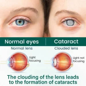 OptiClear Nano Eye Roller Serum - Image 3