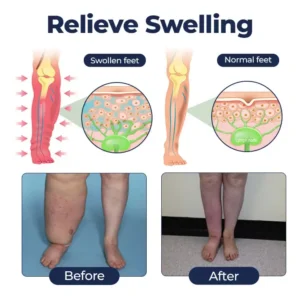SwellRelief Circulation Support Cream - Image 5