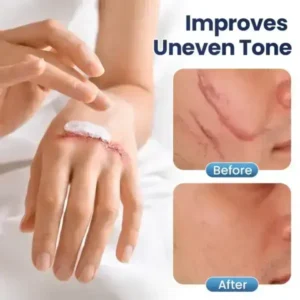 DERMALUX Texture Repair Gel - Image 6