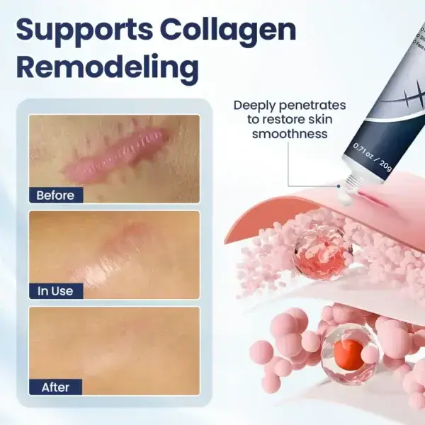 DERMALUX Texture Repair Gel - Image 4