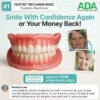 Custom-Fit Full Functional Dentures