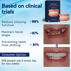 Advanced Full Denture Set - Image 6