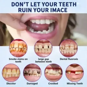 Vaxflite Full Denture Set (Top & Bottom) – Custom Fit Oral Prosthetic - Image 11