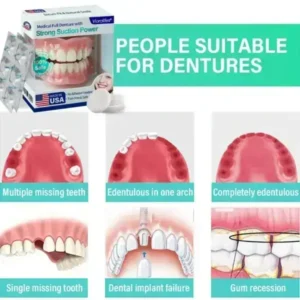 Full Denture with Strong Suction - Image 3