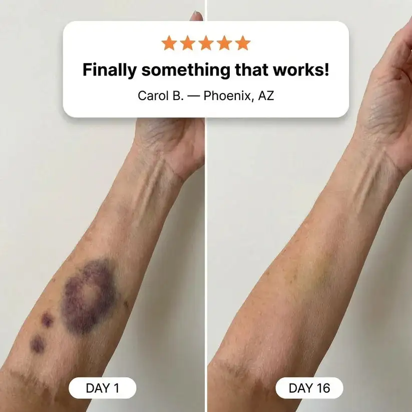 💥300K+ Bruise Repair & Skin-Strengthening Cream - Image 13