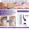 ReGenScar Stem Cell Scar Gel