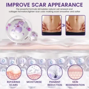 ReGenScar Stem Cell Scar Gel - Image 7