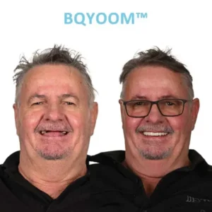 At Home Custom Dentures