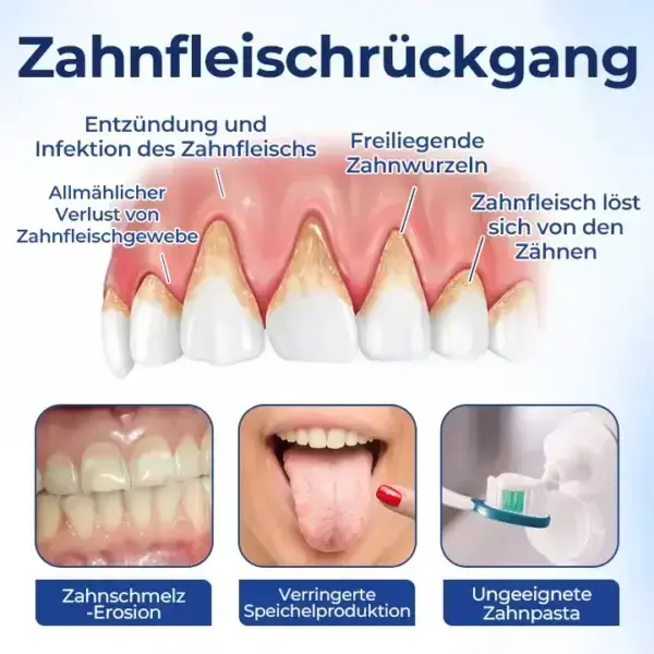 BeeTakt Zahnfleisch-Repair Lösung - Image 9