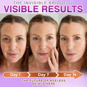 3-in-1 Microneedle Anti-Aging Patch - Image 12