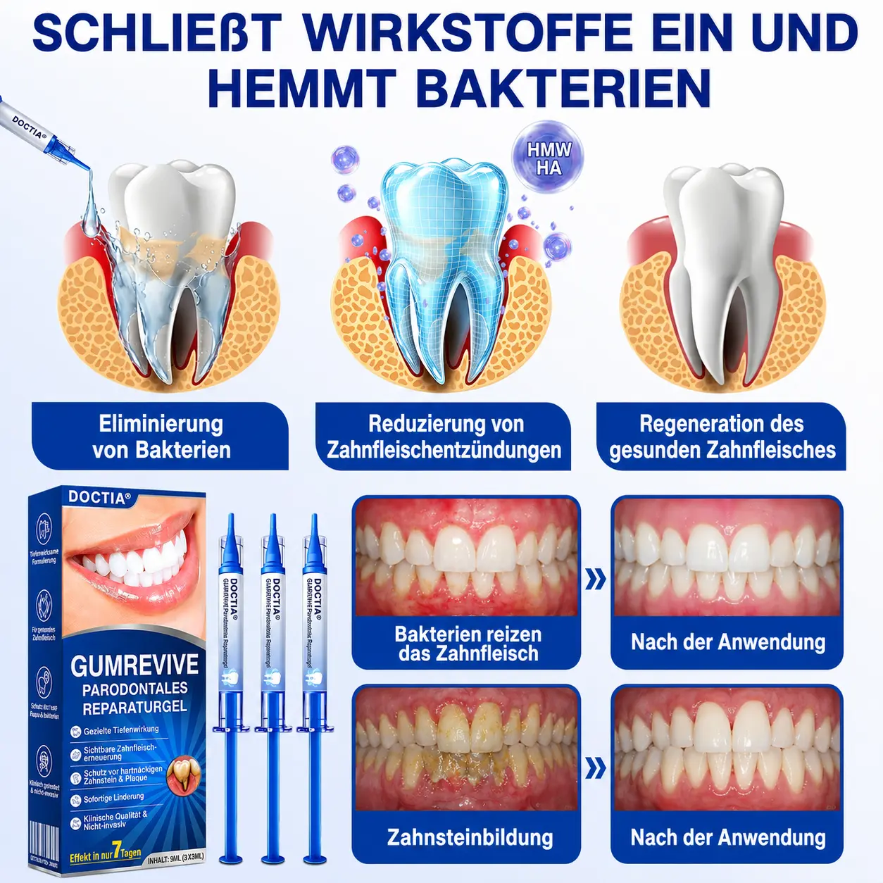 GumRevive Parodontales Reparaturgel - Image 9
