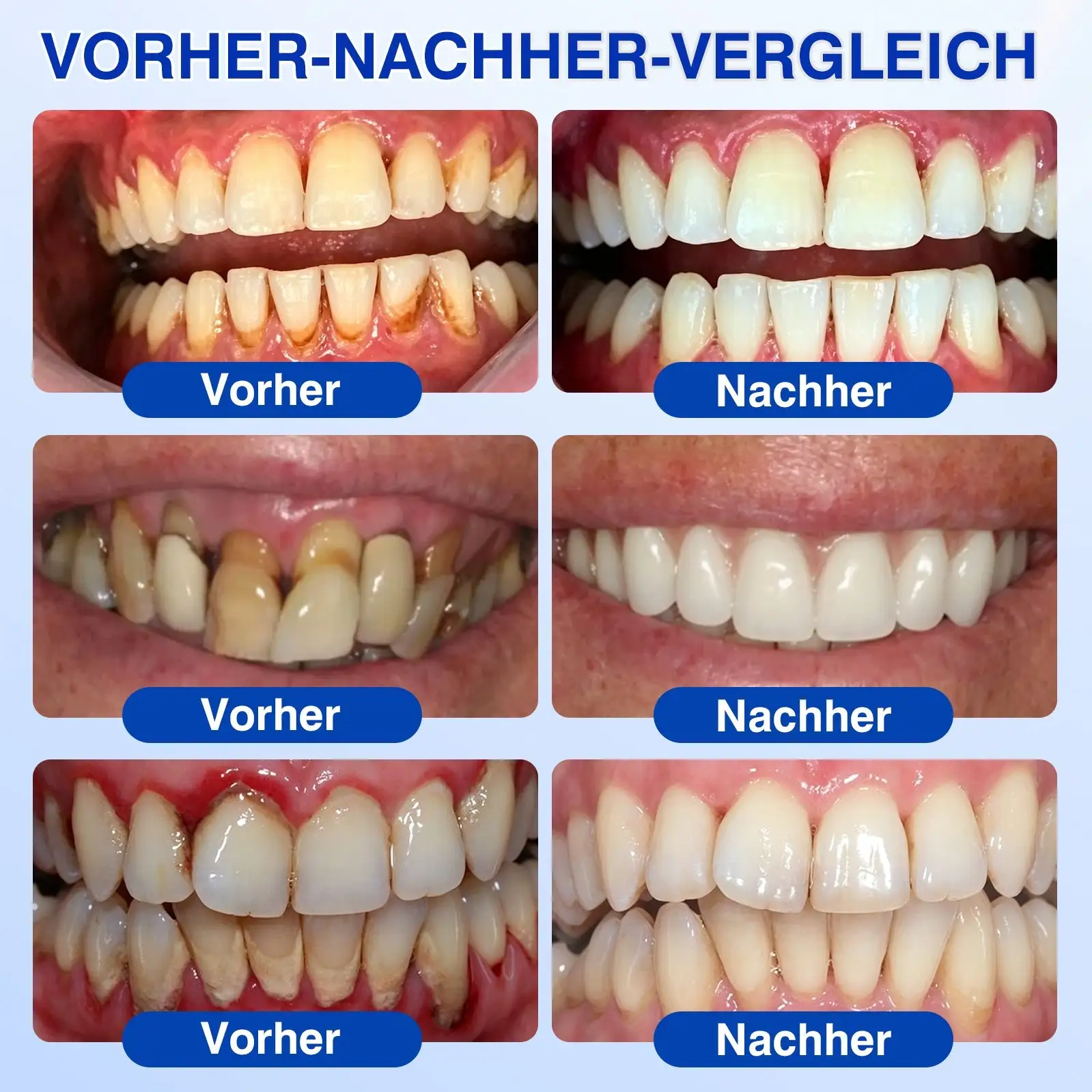 GumRevive Parodontitis Reparaturgel - Image 4