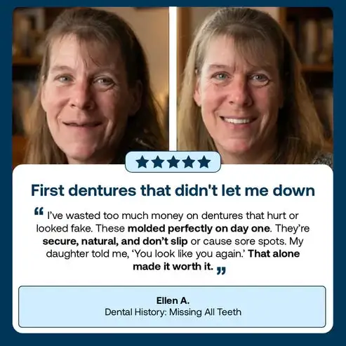 🌎Ends Today: 70% OFF! Custom-Fit Instant Smile Dentures – Natural Looking Comfort Fit - Image 17