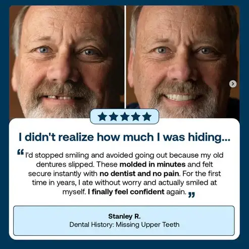 🌎Ends Today: 70% OFF! Custom-Fit Instant Smile Dentures – Natural Looking Comfort Fit - Image 18