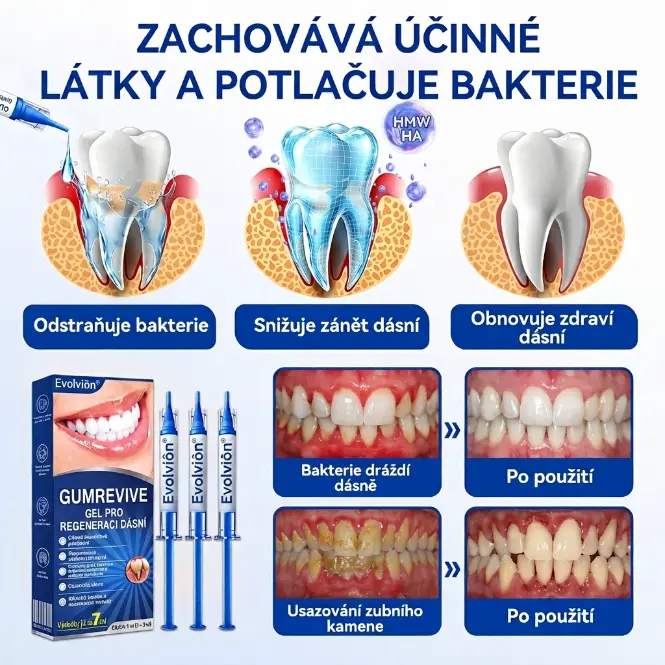 GumRevive Gel - Image 11
