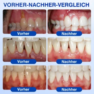 GumRevive Parodontales Reparaturgel - Image 3