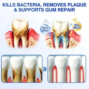 GumRevive Periodontal Repair Gel - Image 12
