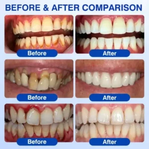 GumRevive Periodontal Repair Gel - Image 18