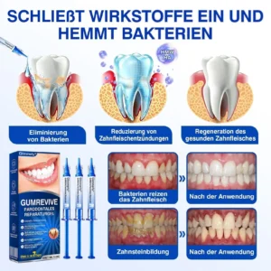 GumRevive Parodontales Reparaturgel - Image 9