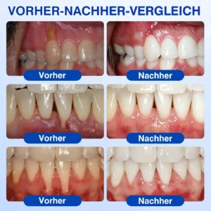 GumRevive Parodontales Reparaturgel - Image 3