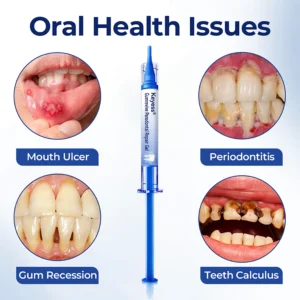 GumRevive Periodontal Repair Gel - Image 2