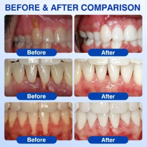 Natravor GumRevive - Image 3