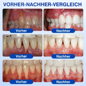 GumRevive Parodontal-Reparaturgel - Image 2